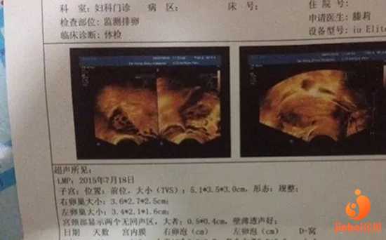 试管代孕群_添一助孕中心_【上海中山医院有供卵试管吗】这次一定好好听话了